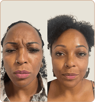 resultado dra lorena estocler (1)