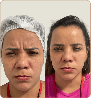 resultado dra lorena estocler (2)