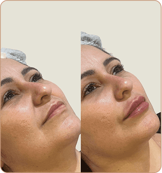 resultado dra lorena estocler (3)