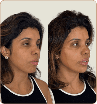 resultado dra lorena estocler (4)