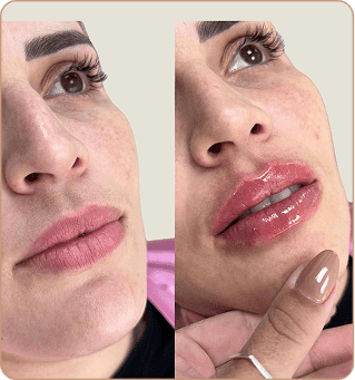 resultado dra lorena estocler (5)