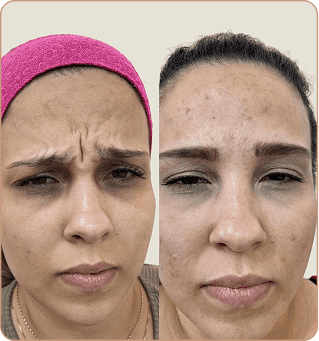 resultado dra lorena estocler (6)