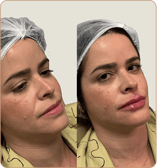 resultado dra lorena estocler (7)