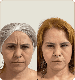 resultado dra lorena estocler (8)