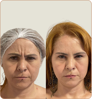 resultado dra lorena estocler (8)